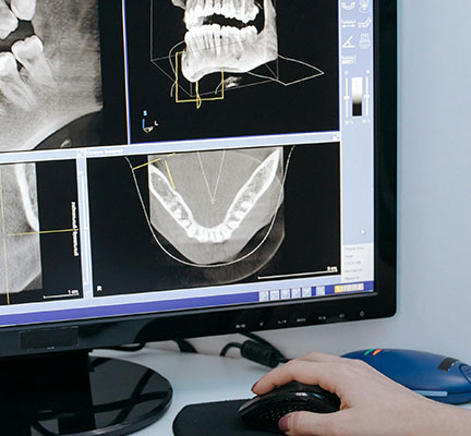 Patient Services Flouroscans: Dynamic xray technology for small bones